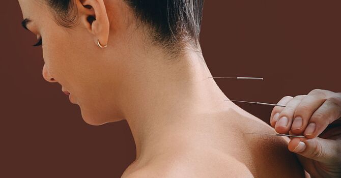 Facial Microneedling